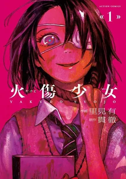 Yakedo Shoujo